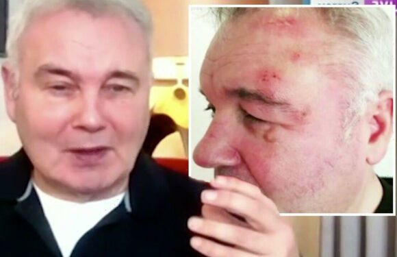 Eamonn Holmes claims shingles battle ‘ruined’ son’s wedding day
