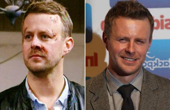 Emmerdale’s Tom Lister in surprise career change 10 years after shock murder of evil villain Carl King | The Sun