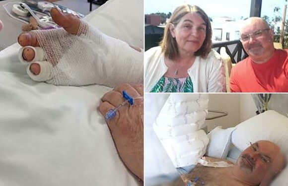 Factory worker, 59, lost his hand in an industrial accident