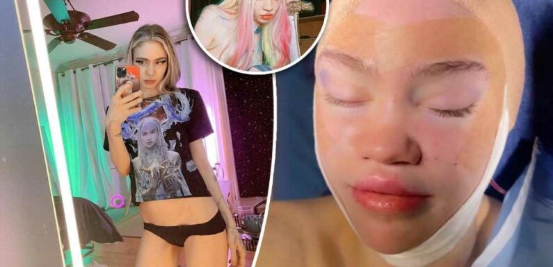 Grimes shares pic of bandaged face after saying she wanted ‘elf ear’ surgery