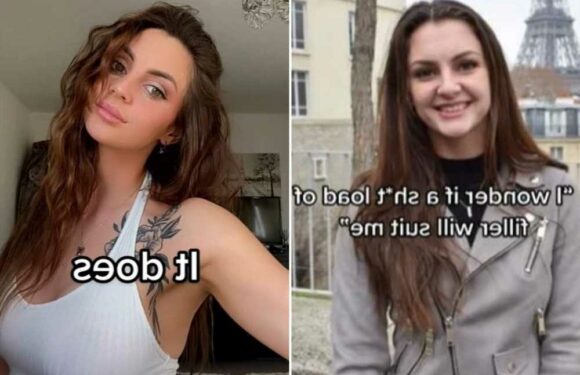 I completely transformed my face with fillers and look like a different person – trolls are vicious but I love it | The Sun