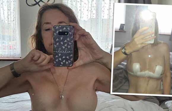 I flew to Turkey to have cheap mummy makeover – my boobs were butchered & my nipples were left sagging under implants | The Sun