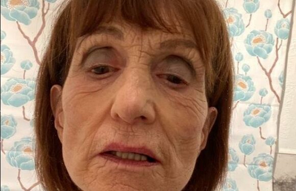 I won £13,000 after a trip to the dentist left me unable to eat anything but soup | The Sun