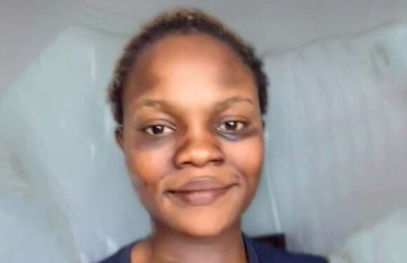 I’m a major catfish, I change my eye color and hair color – people say it ‘should be illegal’ | The Sun