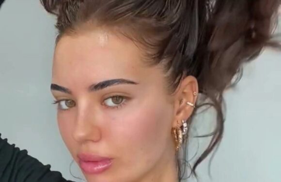 I'm a 'greasy hair queen' & can go eight days without washing my locks – trolls call me 'flaky' but I don't care | The Sun