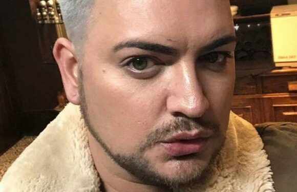 Man ‘bullied for looking like Alan Carr’ regrets spending £16k on ‘perfect’ face