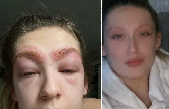 Mother suffered allergic reaction to Superdrug eyebrow tinting
