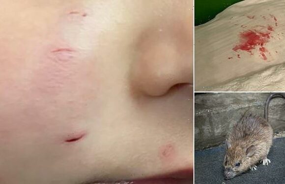 Mother traumatised when she found a RAT biting her toddler's face