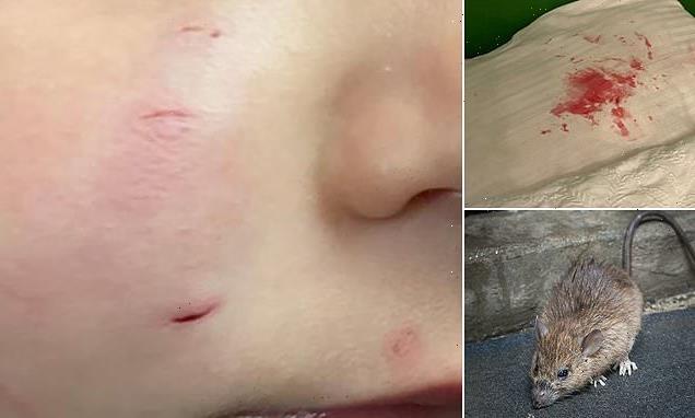 Mother traumatised when she found a RAT biting her toddler's face