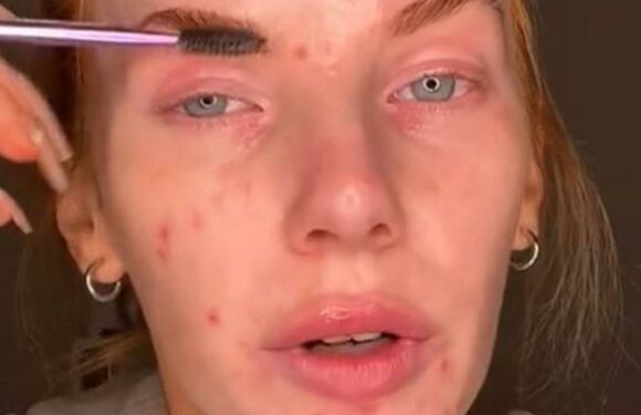People call me a catfish & think I’m a drug addict when they see my acne but are stunned at how I look with makeup on | The Sun