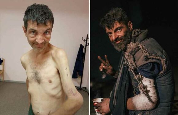 Ukrainian soldier reveals shocking war injuries after POW was captured by Russian forces in besieged Mariupol | The Sun