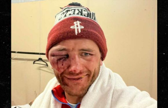 Bare Knuckle Boxing's Nathan Decastro Shows Gruesome Eye Injury After Fight