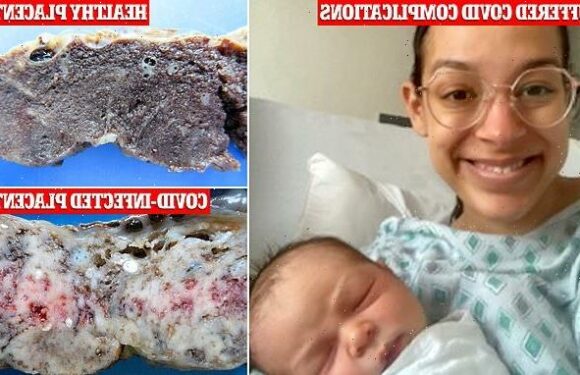 COVID blamed for spike in potentially deadly pregnancy complications