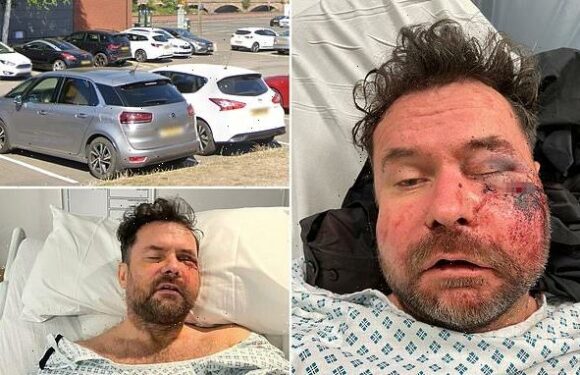 Father left for dead by feral youths in attack 'asking for directions'