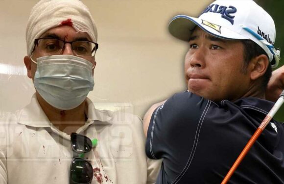 Hideki Matsuyama Drills Fan In Head W/ Errant Drive, Leaves Gory Wound