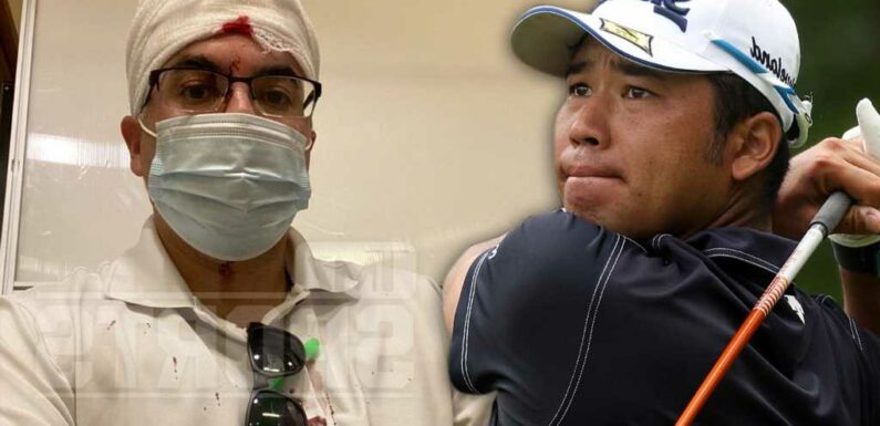 Hideki Matsuyama Drills Fan In Head W/ Errant Drive, Leaves Gory Wound