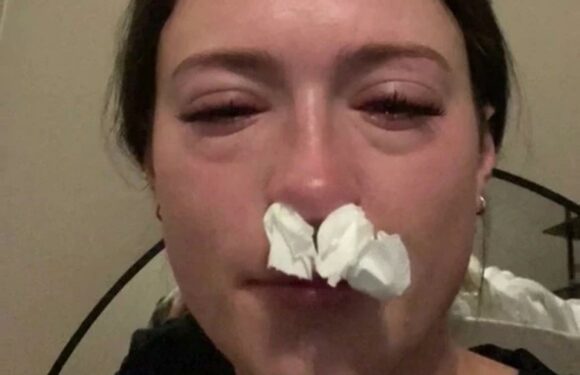 I got lash extensions but little did I know I was allergic to lash glue… my eyes turned red & I could barely open them | The Sun