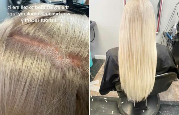 I got my hair bleached but ended up with chemical burns & shivers it hurt so much – I still paid full price | The Sun