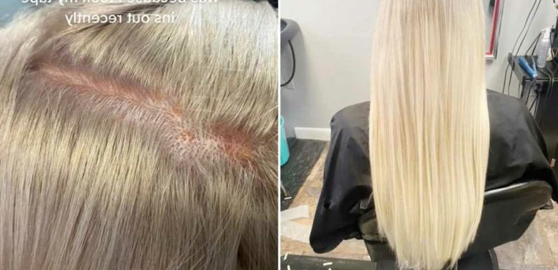 I got my hair bleached but ended up with chemical burns & shivers it hurt so much – I still paid full price | The Sun