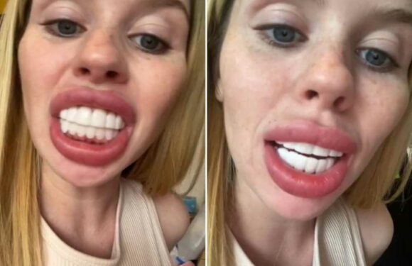 I spent £180 on clip in veneers to end up looking like a horse – I can't even speak with them in, what a waste of money | The Sun