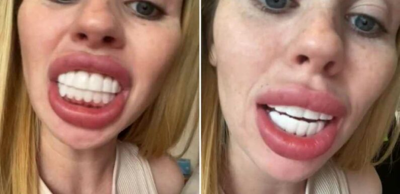 I spent £180 on clip in veneers to end up looking like a horse – I can't even speak with them in, what a waste of money | The Sun