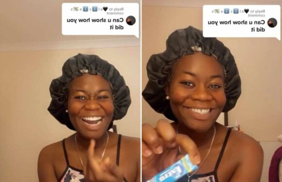 I used to hate the gap between my teeth so much I made a fake took out of chewing gum to hide it – it never went well | The Sun