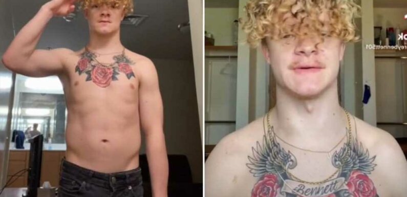 I was born with no collarbones and now I’m the shoulder clapping King | The Sun