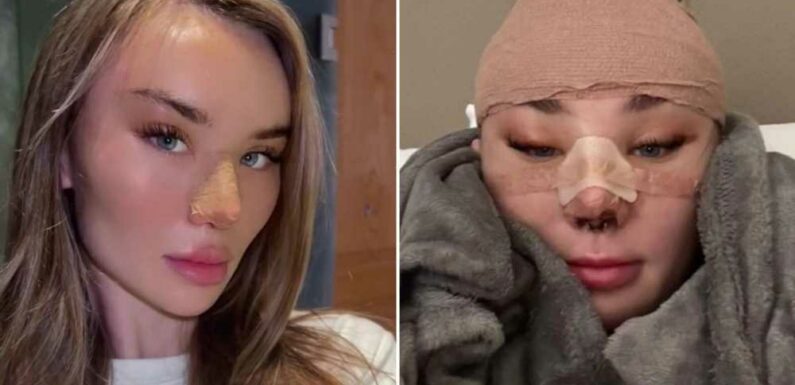 I’m 22 and in love with surgery – people tell me to stop but I've spent over £10k on nose jobs, a face lift and more | The Sun