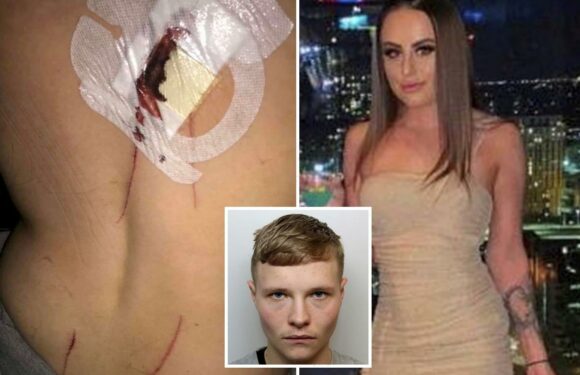 I'm scarred for life after a stranger attacked me with a zombie knife – I didn't know how bad it was until I looked down | The Sun