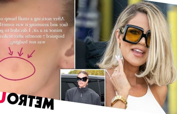 Khloe Kardashian has tumour removed from face amid skin cancer scare