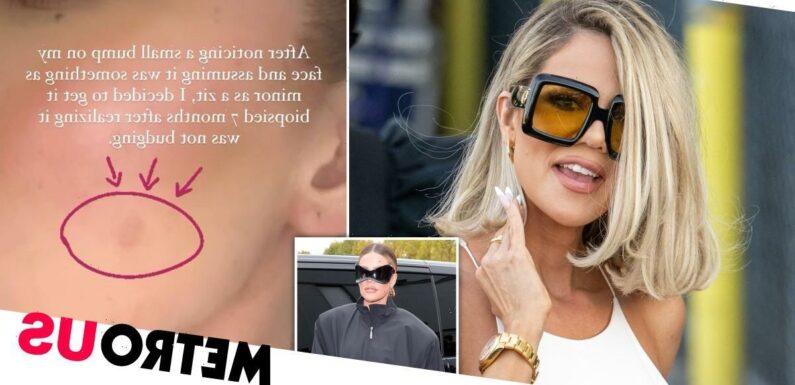 Khloe Kardashian has tumour removed from face amid skin cancer scare