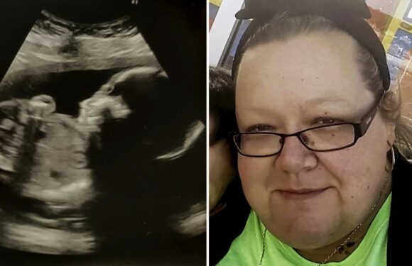 Midwives ‘misread scans’ and didn’t listen to me – a day later my baby died in the womb | The Sun