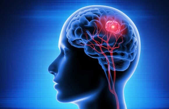 New treatment 'cures' aggressive brain cancer – stopping tumours in their tracks | The Sun