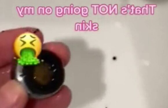 People are just realizing how gross the inside their faucet can get & it may be the reason you have bad skin | The Sun