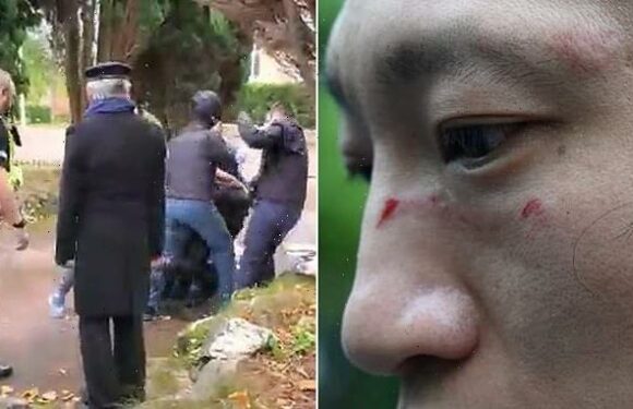 Pictured: Bloody face of protester beaten outside UK Chinese consulate