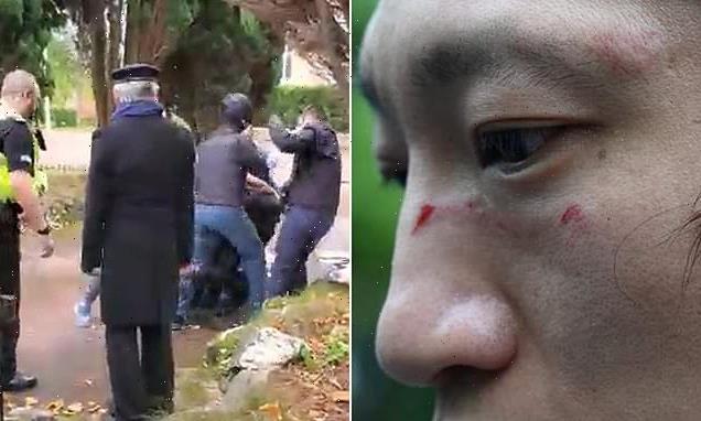 Pictured: Bloody face of protester beaten outside UK Chinese consulate
