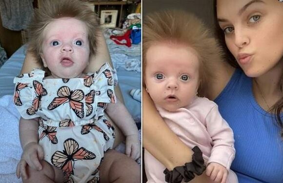 Ten-week-old tot is born with hair that sticks up in every direction