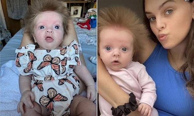 Ten-week-old tot is born with hair that sticks up in every direction