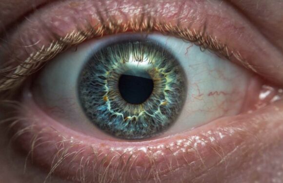 The signs in your eyes that mean you could be living with silent killer | The Sun