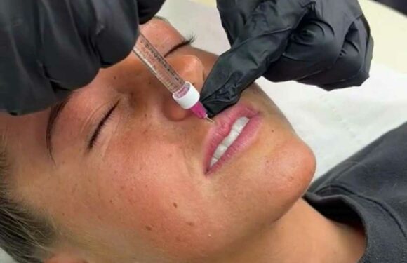 Trolls say my lips look wonky but I don't care – now I’ve finally got them done I’ll definitely plump them again | The Sun