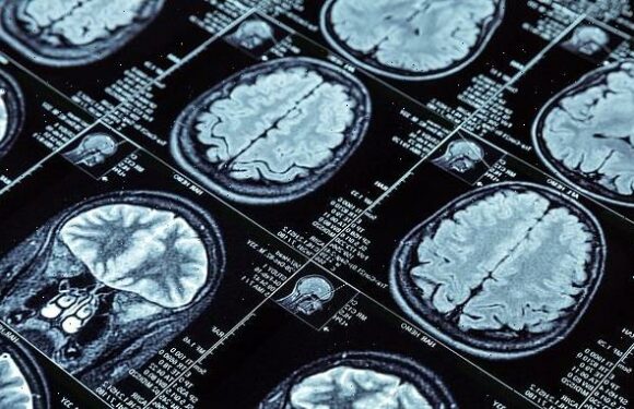 British father reveals he could only speak in FRENCH during seizure