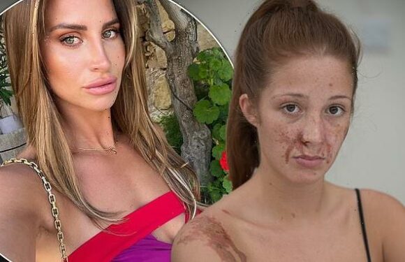 Ferne McCann blasted over 'insincere' apology by acid attack victim