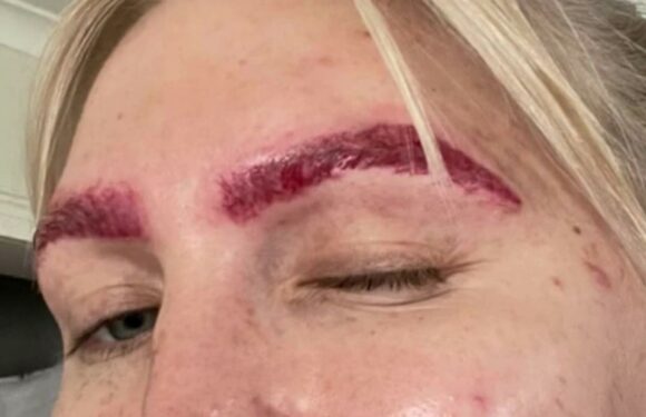 I got my eyebrows tattooed but it was a big fail – I've had them removed FIVE times & they still look like botched slugs | The Sun