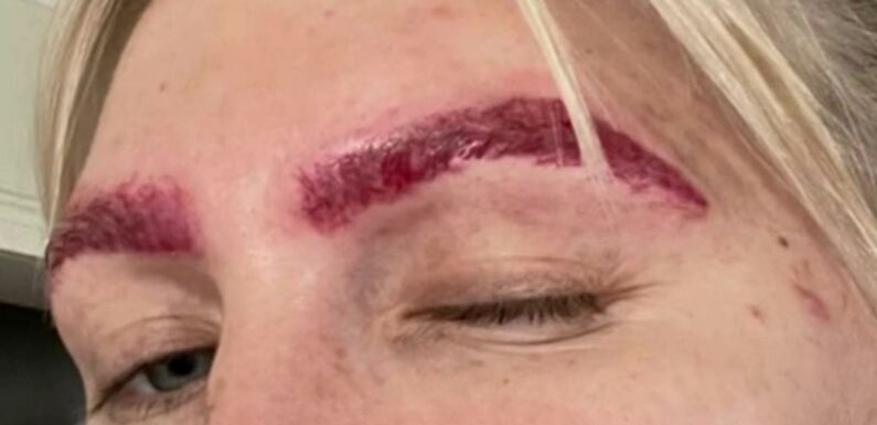 I got my eyebrows tattooed but it was a big fail – I've had them removed FIVE times & they still look like botched slugs | The Sun