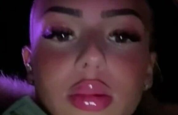 I love filler and I’ve had 8ml injected into my lips – people think it looks stupid but I don’t care | The Sun