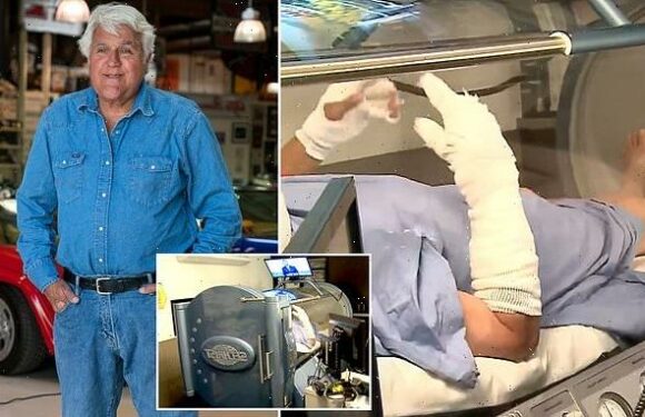 Jay Leno is seen with bandaged hands and arms in hyperbaric chamber