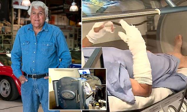 Jay Leno is seen with bandaged hands and arms in hyperbaric chamber