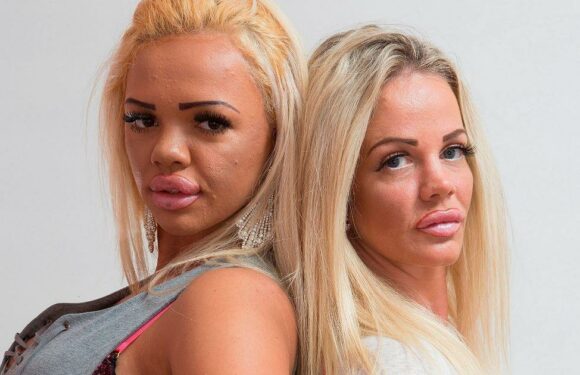 Obsessed fans who abused plastic surgery to look like their famous idols