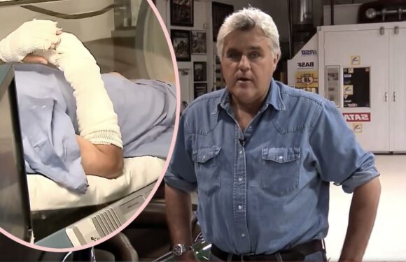 Recovering Jay Leno Seen For First Time Since Suffering Horrible Burns