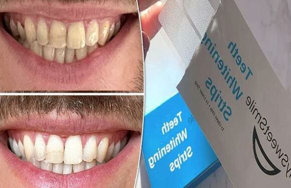 These £30 teeth whitening strips make their smile 'sparkle again'